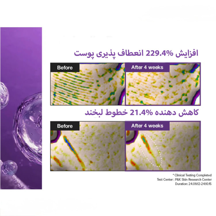سرم لیفتینگ شماره ۹ نامبوزین
